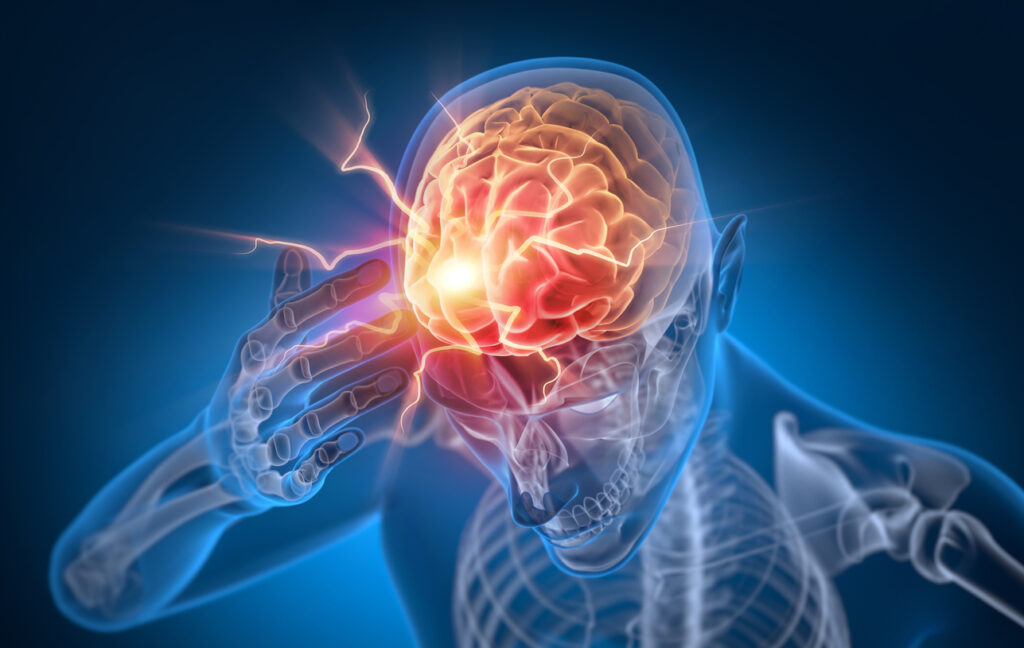Top-Rated Traumatic Brain Injury Attorneys in Charlotte